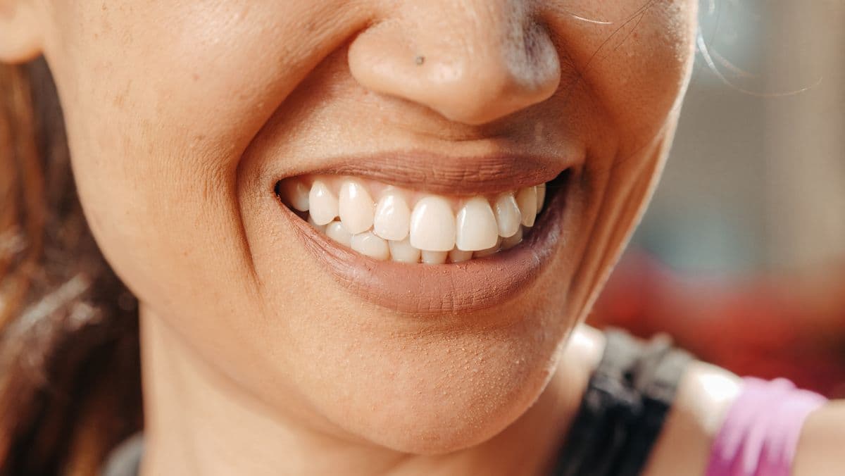 A confident, healthy smile after restorative treatment