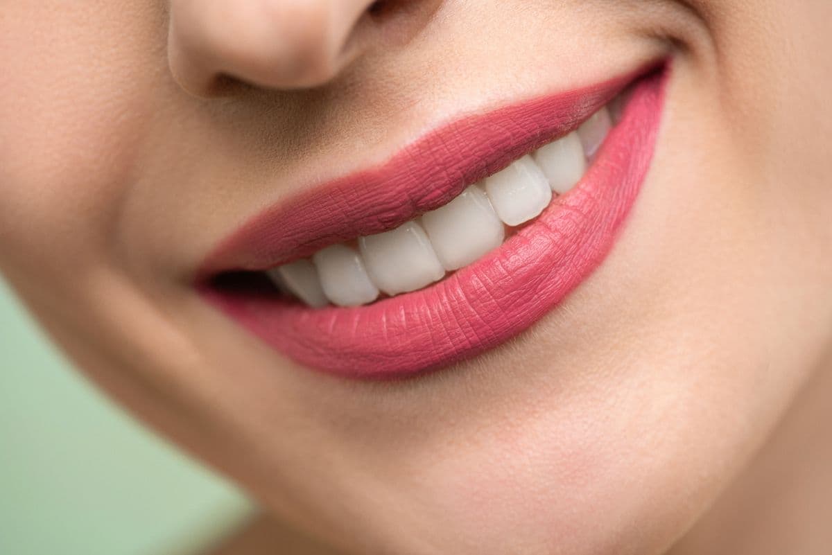A bright, natural smile after professional whitening